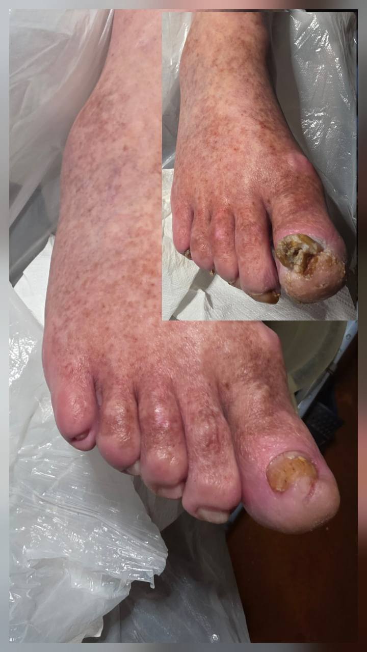 Treatment result 1