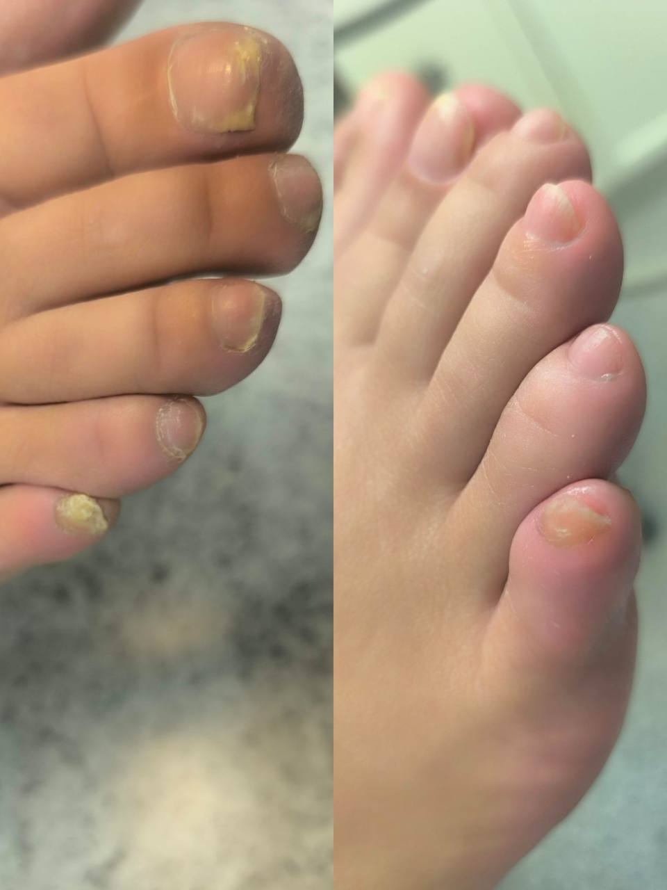 Treatment result 2