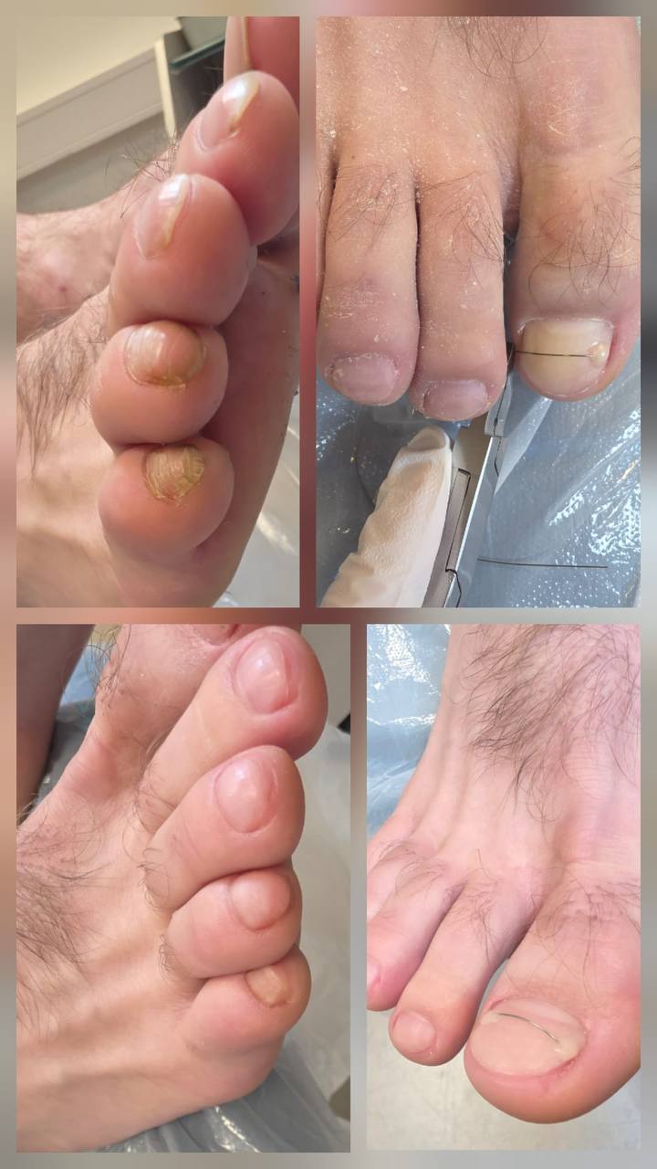 Treatment result 4