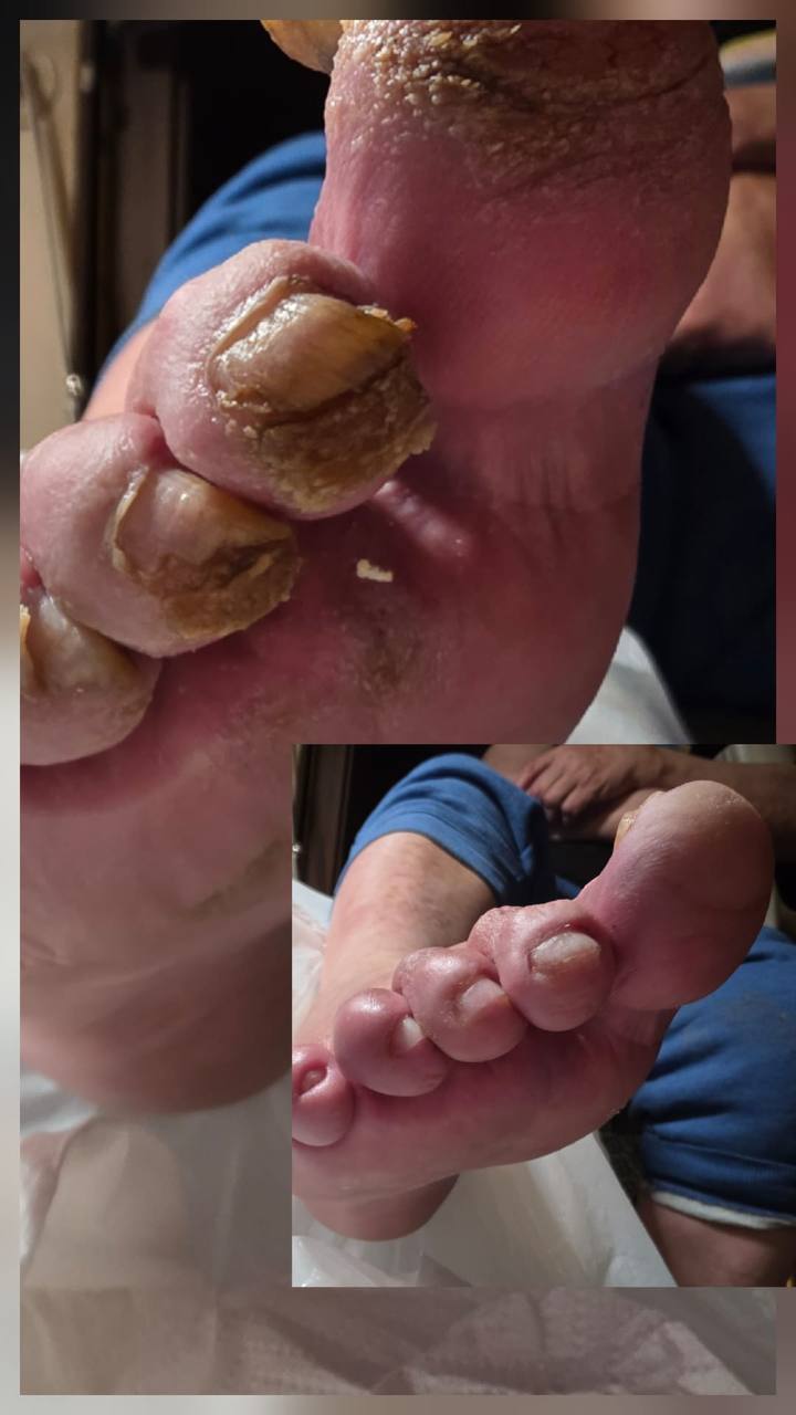Treatment result 5