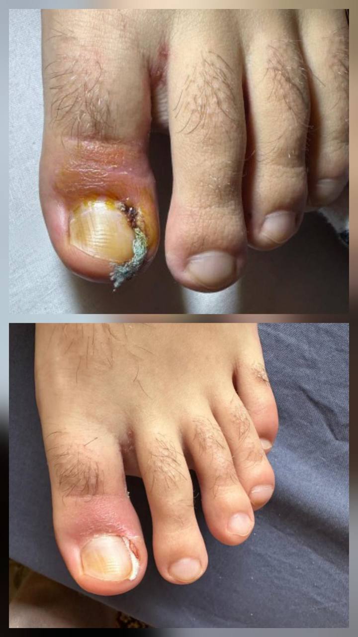 Treatment result 6