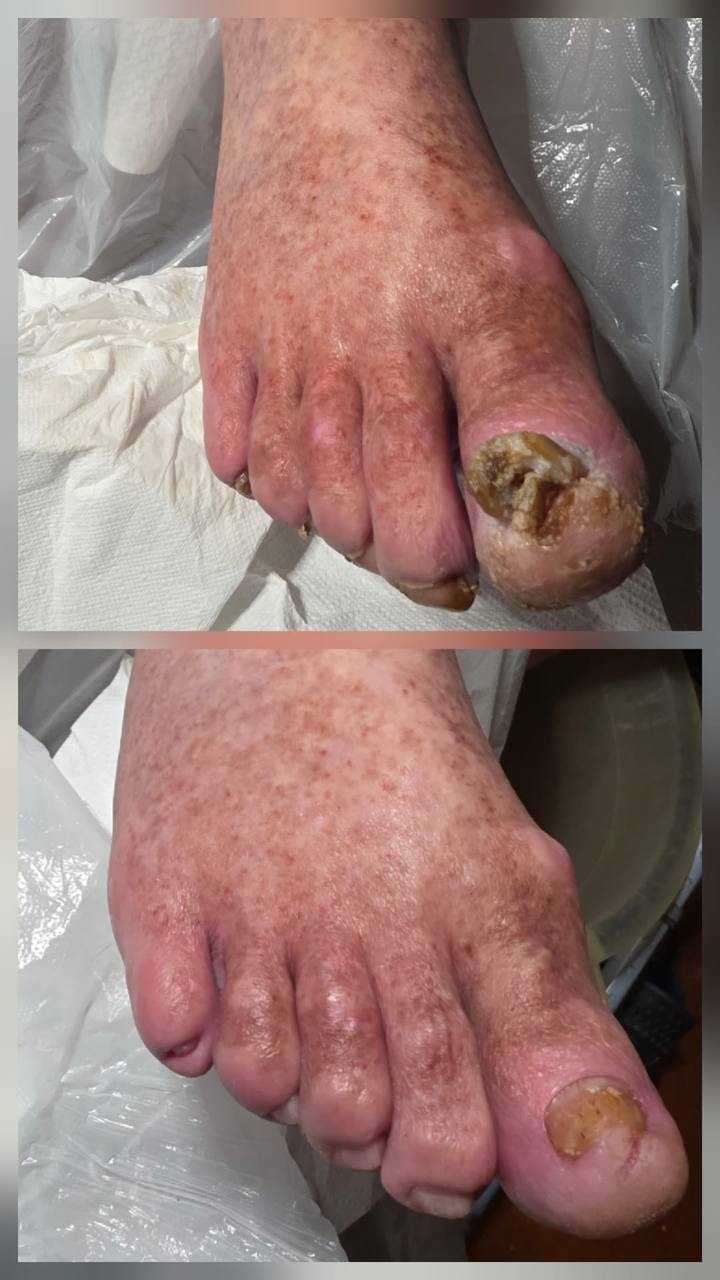 Treatment result 7