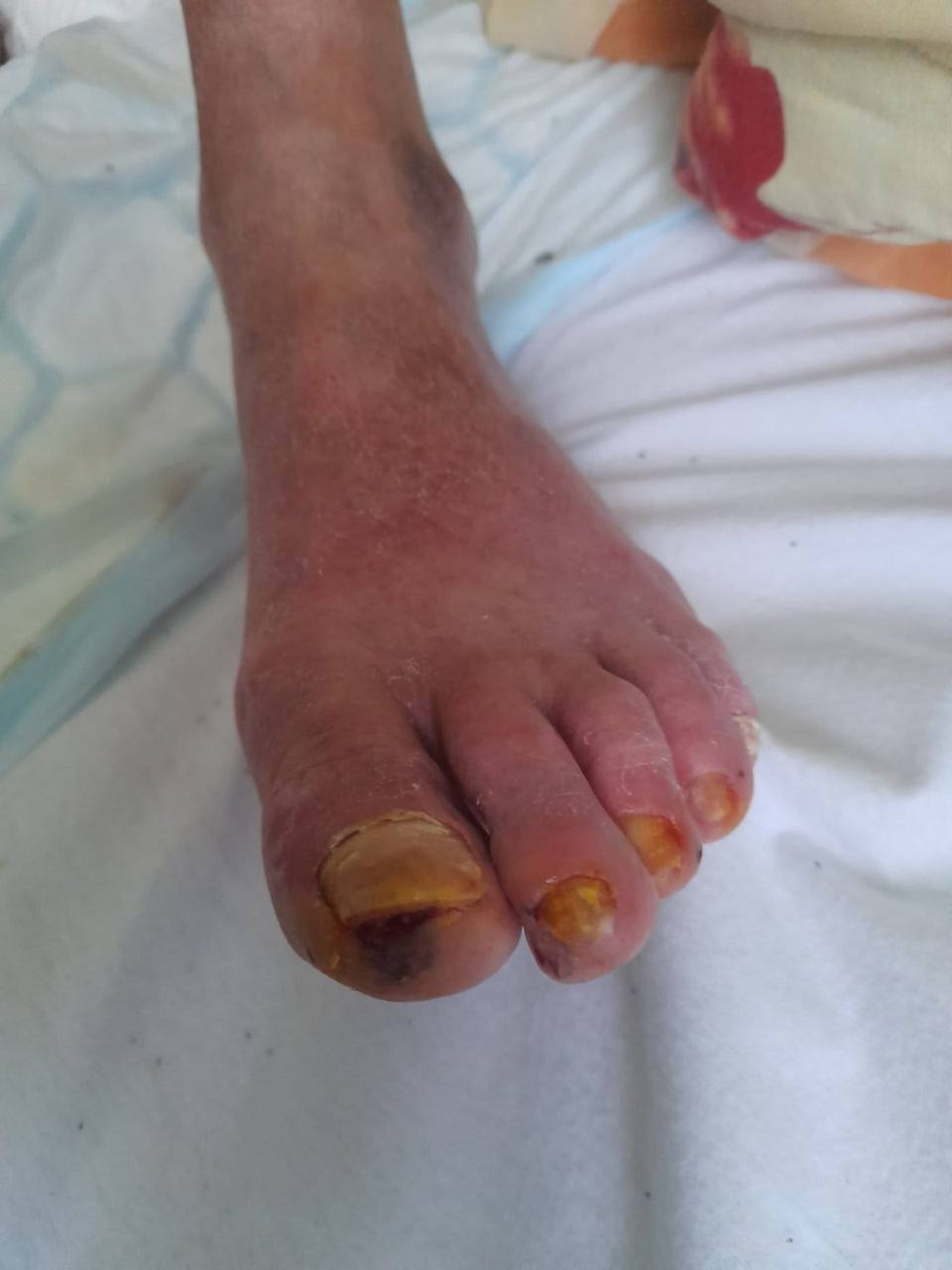 Treatment result 8